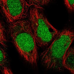 DDX11 Antibody, Novus Biologicals:Antibodies:Primary Antibodies